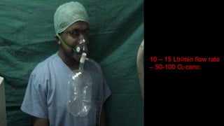 10 – 15 Ltr/min flow rate
– 50-100 O2 conc.
 