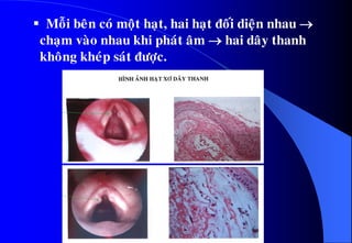  Moãi beân coù moät haït, hai haït ñoái dieän nhau 
chaïm vaøo nhau khi phaùt aâm  hai daây thanh
khoâng kheùp saùt ñöôïc.
 