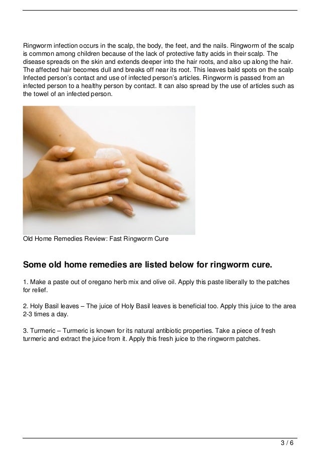 Old Home Remedies Review Fast Ringworm Cure