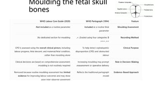 Moulding the fetal skull
bones
 