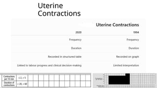 Uterine
Contractions
 