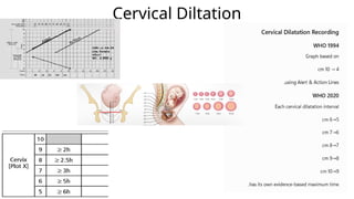 Cervical Diltation
 