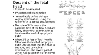 Descent of the fetal
head
• It should be assessed
• by abdominal examination
• immediately before doing a
vaginal examination, using the
rule of fifth to assess engagement
• The rule of fifth means the
palpable fifth of the fetal head are
felt by abdominal examination to
be above the level of symphysis
pubis
• When 2/5 or less of fetal head is
felt above the level of symphysis
pubis , this means that the head is
engage , and by vaginal
examination , the lowest part of
vertex has passed or is at the level
 