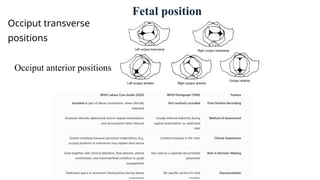 Occiput transverse
positions
Occiput anterior positions
Fetal position
 