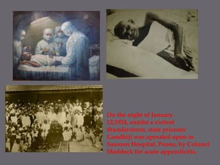 On the night of January 12,1924, amidst a violent thunderstorm, state prisoner Gandhiji was operated upon in Sassoon Hospital, Poona, by Colonel Maddock for acute appendicitis. 
