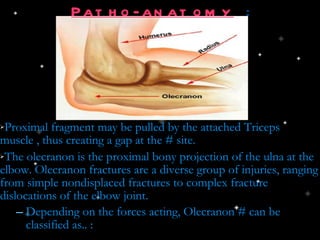 Patho-anatomy  : Proximal fragment may be pulled by the attached Triceps muscle , thus creating a gap at the # site. The olecranon is the proximal bony projection of the ulna at the elbow. Olecranon fractures are a diverse group of injuries, ranging from simple nondisplaced fractures to complex fracture dislocations of the elbow joint. Depending on the forces acting, Olecranon # can be classified as.. : 