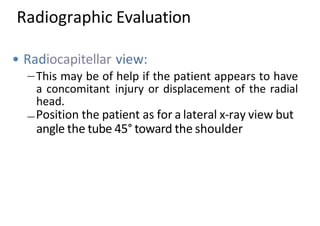 • Radiocapitellar view:
This may be of help if the patient appears to have
a concomitant injury or displacement of the radial
head.
Position the patient as for a lateral x-ray view but
angle the tube 45° toward the shoulder
Radiographic Evaluation
 