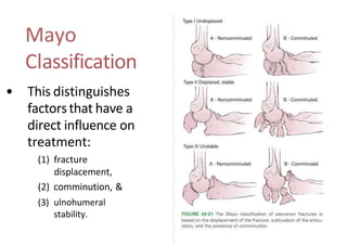Mayo
Classification
• This distinguishes
factorsthat have a
direct influence on
treatment:
(1) fracture
displacement,
(2) comminution, &
(3) ulnohumeral
stability.
 