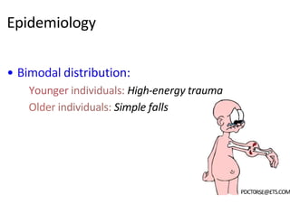 • Bimodal distribution:
Younger individuals: High-energy trauma
Older individuals: Simple falls
PDCT0RSE@£TS.COM
Epidemiology
 