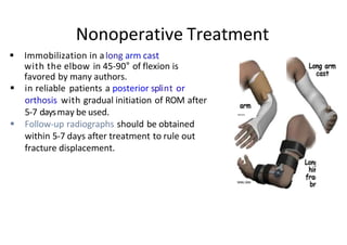 Nonoperative Treatment
 Immobilization in along arm cast
with the elbow in 45-90° of flexion is
favored by many authors.
 in reliable patients a posterior splint or
orthosis with gradual initiation of ROM after
5-7 daysmay be used.
 Follow-up radiographs should be obtained
within 5-7 days after treatment to rule out
fracture displacement.
 