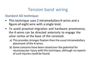 Tension band wiring
Standard AO technique:
• This technique uses 2 intramedullary K-wires and a
figure-of-eight wire with a single knot.
• To avoid proximal migration and hardware prominence,
the K-wires can be directed anteriorly to engage the
ulnar cortex at the base of the coronoid.
a) This provides stronger fixation than the usual intramedullary
placement of the K-wires.
b) Some concerns have been raised over the potential for
neurovascular injury with this technique, although no reports
of such injuries could be found.
 