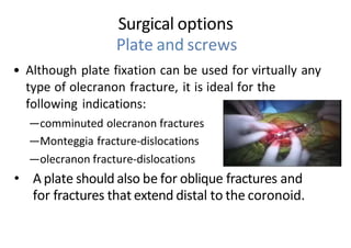 Surgical options
Plate and screws
• Although plate fixation can be used for virtually any
type of olecranon fracture, it is ideal for the
following indications:
—comminuted olecranon fractures
—Monteggia fracture-dislocations
—olecranon fracture-dislocations
• A plate should also be for oblique fractures and
for fractures that extend distal to the coronoid.
 