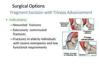 Surgical Options
Fragment Excision with Triceps Advancement
• Indications:
—Nonunited fractures
—Extensively comminuted
fractures
—Fractures in elderly individuals
with severe osteopenia and low
functional requirements
 