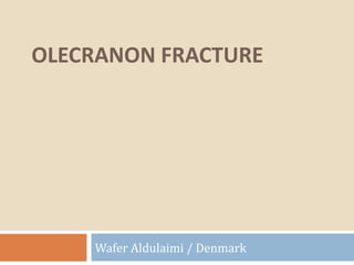 OLECRANON FRACTURE

Wafer Aldulaimi / Denmark

 