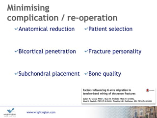www.wrightington.com
Minimising
complication / re-operation
18
Anatomical reduction
Bicortical penetration
Subchondral placement
Patient selection
Fracture personality
Bone quality
 