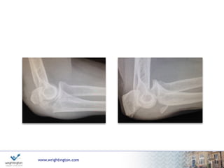 www.wrightington.com
27
 