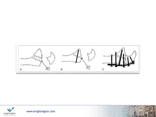 www.wrightington.com
51
 