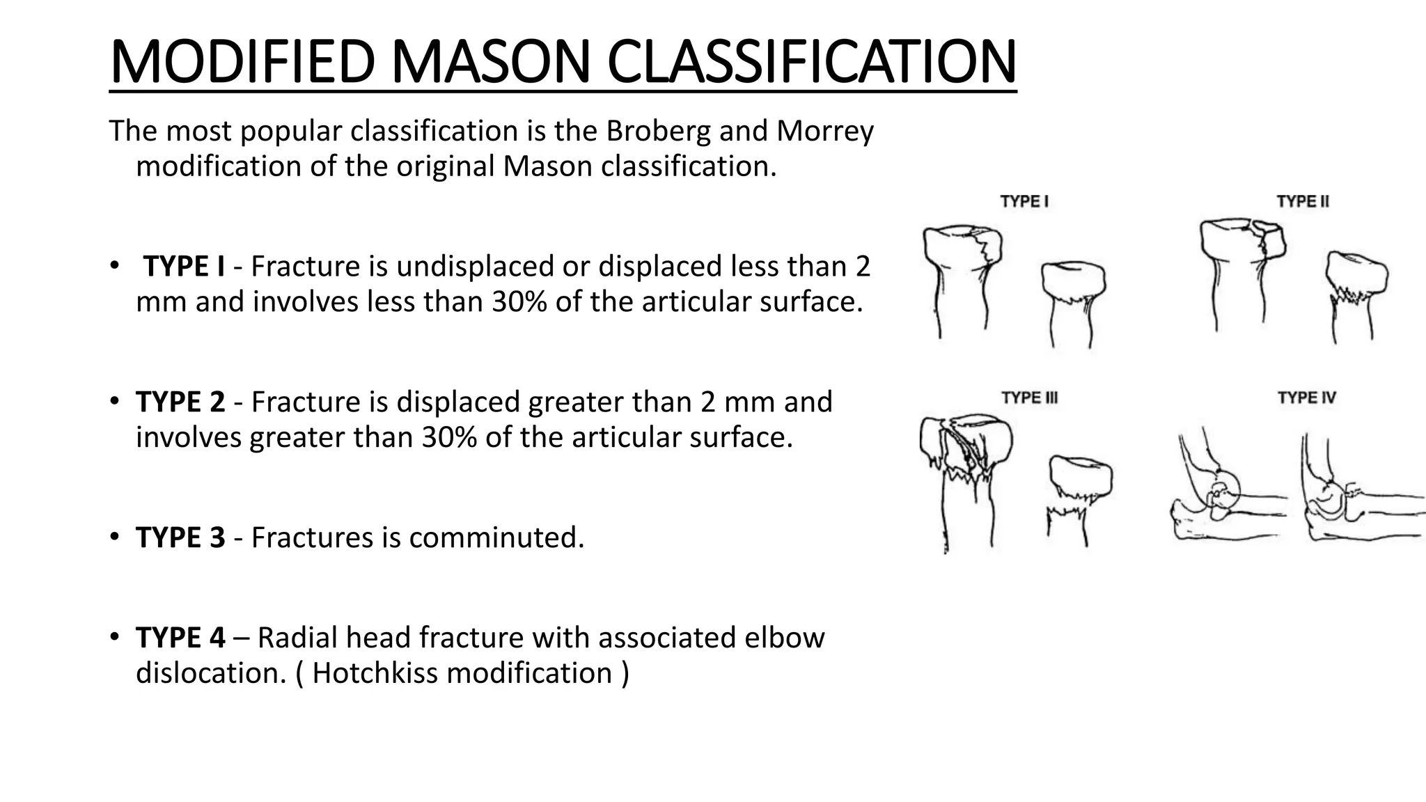Olecronon and radial head fractures (1).pptx