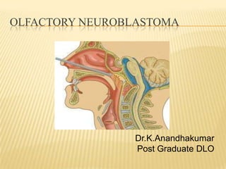 OLFACTORY NEUROBLASTOMA




                 Dr.K.Anandhakumar
                 Post Graduate DLO
 