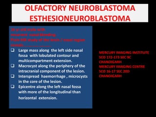 OLFACTORY NEUROBLASTOMA ESTHESIONEUROBLASTOMA  16 yr old male with                                                                         recurrent  nasal bleeding. Plain MR study of the brain / nasal region reveals ....................... ,[object Object]