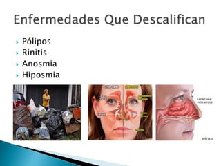  Pólipos
 Rinitis
 Anosmia
 Hiposmia
 