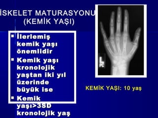 İSKELET MATURASYONU
(KEMİK YAŞI)
KEMİK YAŞI: 10 yaş
 İlerlemişİlerlemiş
kemik yaşıkemik yaşı
önemlidirönemlidir
 Kemik yaşıKemik yaşı
kronolojikkronolojik
yaştan iki yılyaştan iki yıl
üzerindeüzerinde
büyük isebüyük ise
 KemikKemik
yaşı>3SDyaşı>3SD
kronolojik yaşkronolojik yaş
 