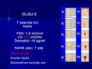 OLGU:5
FSH: 1,6 mIU/ml
LH: 0.2 mIU/ml
Östradiol: <5 pg/ml
7 yaşında kız
hasta
Kemik yaşı: 7 yaş
Uterus 36 mm
Overler küçük
Endometrium kalınlığı yok
 