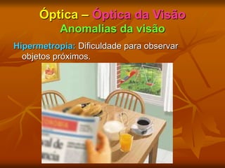 Óptica – Óptica da Visão
Anomalias da visão
Hipermetropia: Dificuldade para observar
objetos próximos.
 