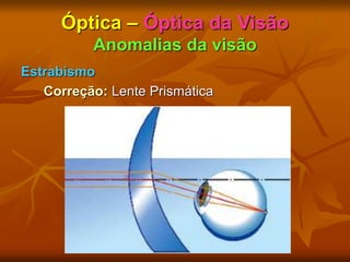 Óptica – Óptica da Visão
Anomalias da visão
Estrabismo
Correção: Lente Prismática
 