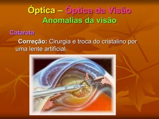 Óptica – Óptica da Visão
Anomalias da visão
Catarata
Correção: Cirurgia e troca do cristalino por
uma lente artificial.
 