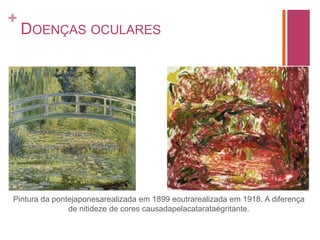 Temas religiososPapa João XXIPedro Rebuli-Giuliani (Português)Médico Oftalmologista Único a se tornar papaMédico particular do Papa Gregório XProfessor de Medicina em MontpellierEscreveu 17 obras médicasThesaurus pauperum (Tesouro dos pobres) – descrevia sintomas de diversas doenças dos pés à cabeça com o remédio adequadoLiber de Oculis – Coletânea de escritos antigos relacionados aos olhosConsagrado papa em 1276 – oitomesese doze dias, morreutragicamenteesmagado por uma coluna do teto do laboratório de pesquisas que mandaraconstruir em Viterbo, àépocasede do papado.Único papa que Dante Alighieri, em A DivinaComédia, colocou no Paraíso (canto XII, verso 133).