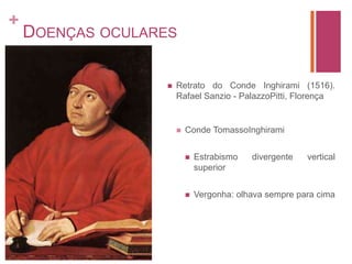 Doenças ocularesClaude MonetImpressionistaCatarata (dignóstico aos 72 anos)Memória e LembrançasPercepção das coresBrancos, verdeseazuisamareloeroxoPaletaverde-azullaranja-vermelhoCirurgia – destruiumuitosquadrosMulheres no jardim de 1866Impressão, nascer do solCasa de Monet em Argenteuil