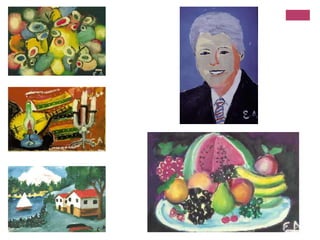 Doenças ocularesRetrato do Conde Inghirami (1516). Rafael Sanzio - PalazzoPitti, FlorençaConde TomassoInghiramiEstrabismo divergente vertical superiorVergonha: olhava sempre para cima