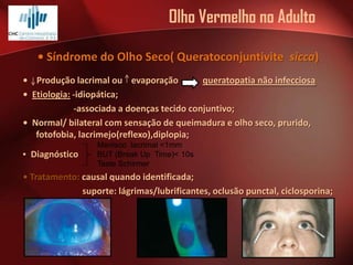 Olho Vermelho no Adulto
• Síndrome do Olho Seco( Queratoconjuntivite sicca)
• Produção lacrimal ou evaporação
queratopatia não infecciosa
• Etiologia: -idiopática;
-associada a doenças tecido conjuntivo;
• Normal/ bilateral com sensação de queimadura e olho seco, prurido,
fotofobia, lacrimejo(reflexo),diplopia;
• Diagnóstico

Menisco lacrimal <1mm
BUT (Break Up Time)< 10s
Teste Schirmer

• Tratamento: causal quando identificada;
suporte: lágrimas/lubrificantes, oclusão punctal, ciclosporina;

 