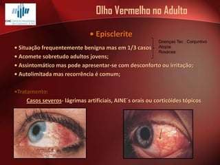 Olho Vermelho no Adulto
• Episclerite
Doenças Tec . Conjuntivo
Atopia
Rosácea

• Situação frequentemente benigna mas em 1/3 casos
• Acomete sobretudo adultos jovens;
• Assintomático mas pode apresentar-se com desconforto ou irritação;
• Autolimitada mas recorrência é comum;

•Tratamento:
Casos severos- lágrimas artificiais, AINE´s orais ou corticóides tópicos

 