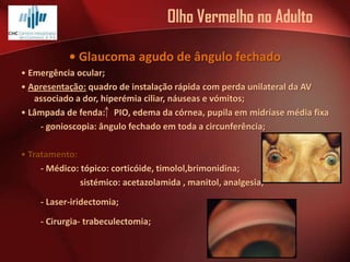 Olho Vermelho no Adulto
• Glaucoma agudo de ângulo fechado
• Emergência ocular;
• Apresentação: quadro de instalação rápida com perda unilateral da AV
associado a dor, hiperémia ciliar, náuseas e vómitos;
• Lâmpada de fenda: PIO, edema da córnea, pupila em midríase média fixa
- gonioscopia: ângulo fechado em toda a circunferência;
• Tratamento:
- Médico: tópico: corticóide, timolol,brimonidina;
sistémico: acetazolamida , manitol, analgesia;
- Laser-iridectomia;
- Cirurgia- trabeculectomia;

 