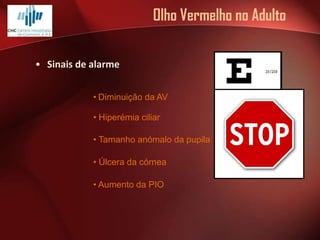 Olho Vermelho no Adulto
• Sinais de alarme
• Diminuição da AV
• Hiperémia ciliar
• Tamanho anómalo da pupila
• Úlcera da córnea
• Aumento da PIO

 