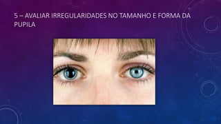 5 – AVALIAR IRREGULARIDADES NO TAMANHO E FORMA DA
PUPILA
 