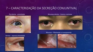 7 – CARACTERIZAÇÃO DA SECREÇÃO CONJUNTIVAL
Purulenta - amarelada Mucopurulenta – branco cremosa
Serosa – aquosa amarelada
Mucosa – filamentar e transparente
 
