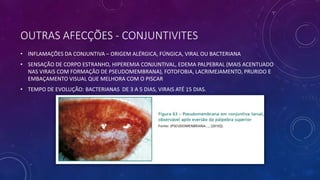 OUTRAS AFECÇÕES - CONJUNTIVITES
• INFLAMAÇÕES DA CONJUNTIVA – ORIGEM ALÉRGICA, FÚNGICA, VIRAL OU BACTERIANA
• SENSAÇÃO DE CORPO ESTRANHO, HIPEREMIA CONJUNTIVAL, EDEMA PALPEBRAL (MAIS ACENTUADO
NAS VIRAIS COM FORMAÇÃO DE PSEUDOMEMBRANA), FOTOFOBIA, LACRIMEJAMENTO, PRURIDO E
EMBAÇAMENTO VISUAL QUE MELHORA COM O PISCAR
• TEMPO DE EVOLUÇÃO: BACTERIANAS DE 3 A 5 DIAS, VIRAIS ATÉ 15 DIAS.
 