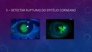 3 – DETECTAR RUPTURAS DO EPITÉLIO CORNEANO
 
