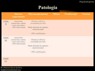 Oligodendroglioma
Patologia
Macros-
copicamente
Microscopicamente Mitose Proliferação Necrose
OMS
II
massa bem
cirunscritas, muitas
vezes com cistos;
>50% lobo frontal
•Núcleos esféricos
circundado por halo
•Rede delicada de capilares
anastomosadas
• 90% calcificações
OMS
III
massa bem
cirunscritas, muitas
vezes com cistos;
>50% lobo frontal
.
•Núcleos esféricos
circundado por halo
•Rede delicada de capilares
anastomosadas
• 90% calcificações
OMS
IV
Dr. Peterson Xavier da Silva
medpeterson@hotmal.com
 