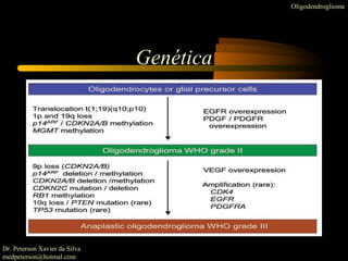 Genética
Oligodendroglioma
Dr. Peterson Xavier da Silva
medpeterson@hotmal.com
 
