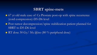 SBRT spine-mets
 67 yr old male case of Ca Prostate post-op with spine recurrence
(cord compression)-D5-D6 level
 Post tumor decompression/spine stabilization patient planned for
SBRT to D5-D6 level
 RT dose 30 Gy/ 5fx @iso (80 % peripheral dose)
 