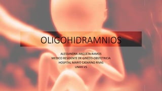 OLIGOHIDRAMNIOS 
ALESSANDRA ARGUETA RAMOS 
MEDICO RESIDENTE DE GINECO-OBSTETRICIA 
HOSPITAL MARIO CATARINO RIVAS 
UNAH-VS 
 