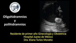 Oligohidramnios
y
polihidramnios
Residente de primer año Ginecología y Obstetrícia
Hospital Juarez de México
Dra. Eliana Turizo Moratto
 