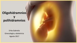 Oligohidramnios
y
polihidramnios
Erika Gabriela
Ginecología y obstetricia
Agosto 2017
 
