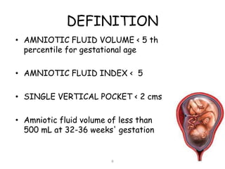 DEFINITION
• AMNIOTIC FLUID VOLUME < 5 th
percentile for gestational age
• AMNIOTIC FLUID INDEX < 5
• SINGLE VERTICAL POCKET < 2 cms
• Amniotic fluid volume of less than
500 mL at 32-36 weeks' gestation
8
 