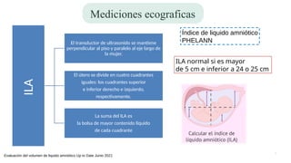 Ila Normal Oligohidramnios y polihidramnios en liquido amniotico de un embarazo | PPTX