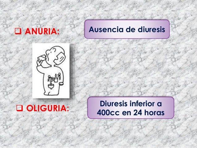 oliguria y anuria oliguria